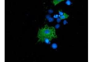Anti-SH2B3 mouse monoclonal antibody (ABIN2454471) immunofluorescent staining of COS7 cells transiently transfected by pCMV6-ENTRY SH2B3 (RC218359). (SH2B3 Antikörper)
