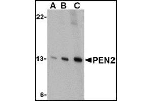 Western blot analysis of PEN2 in K562 cell lysate with this product at (A) 0. (PEN2 Antikörper  (C-Term))