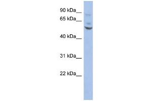 WB Suggested Anti-ETV1 Antibody Titration:  0. (ETV1 Antikörper  (Middle Region))