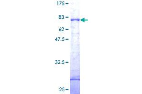 DAP Kinase 1 Protein (AA 1-368) (GST tag)