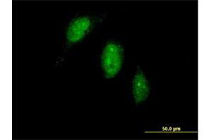 Immunofluorescence of purified MaxPab antibody to TIGD1 on HeLa cell.