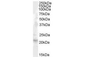 Image no. 1 for anti-Fibroblast Growth Factor 21 (FGF21) (Internal Region) antibody (ABIN374880) (FGF21 Antikörper  (Internal Region))