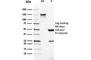SDS-PAGE Analysis Purified Monospecific Mouse Monoclonal Antibody to VISTA (VISTA/2865). (VISTA Antikörper)
