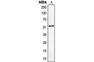 Western Blotting (WB) image for anti-Keratin 13 (KRT13) (Center) antibody (ABIN7296138)
