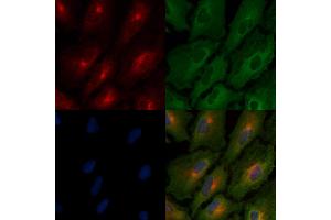 ABIN6264804 and ABIN6266494 staining  cells by IF/ICC. (MST1R Antikörper  (C-Term))