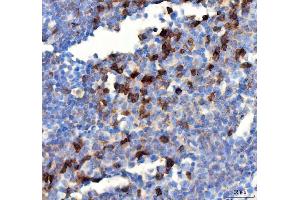 IHC analysis of PDCD1 using anti PDCD1 antibody (ABIN5518784). (PD-1 Antikörper  (N-Term))