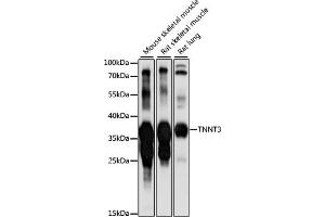 Western blot analysis of extracts of various cell lines, using TNNT3 antibody (ABIN7267145) at 1:1000 dilution. (TNNT3 Antikörper  (AA 147-256))