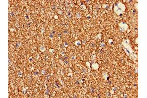 Immunohistochemistry of paraffin-embedded human brain tissue using ABIN7148931 at dilution of 1:100 (CDK5 Antikörper  (AA 1-292))
