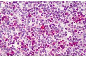 Human Tonsil: Formalin-Fixed, Paraffin-Embedded (FFPE)
