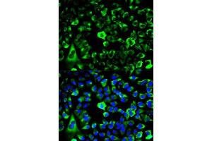 Immunofluorescence analysis of HeLa cells using RPS3 antibody. (RPS3 Antikörper  (AA 1-243))