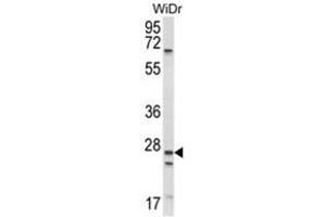 Western blot analysis of SCNN1A Antibody (Center) in WiDr cell line lysates (35ug/lane). (SCNN1A Antikörper  (Middle Region))