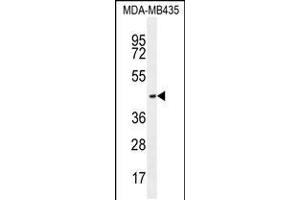 Western blot analysis in MDA-MB435 cell line lysates (35ug/lane). (OR2L13 Antikörper  (C-Term))