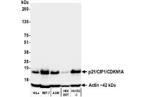 Western Blotting (WB) image for anti-Cyclin-Dependent Kinase Inhibitor 1A (p21, Cip1) (CDKN1A) (AA 100-150) antibody (ABIN7795764)