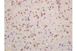 Formalin-fixed and paraffin embedded rat brain labeled with Anti-phospho-FMRP (Ser500) Polyclonal Antibody, Unconjugated (ABIN1714273) at 1:200 followed by conjugation to the secondary antibody and DAB staining