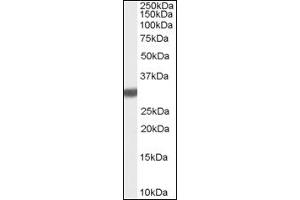 Image no. 1 for anti-Latexin (LXN) (C-Term) antibody (ABIN374848) (Latexin Antikörper  (C-Term))
