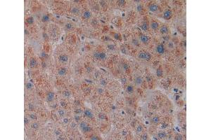 IHC-P analysis of Human Tissue, with DAB staining. (MGLL Antikörper  (AA 1-303))