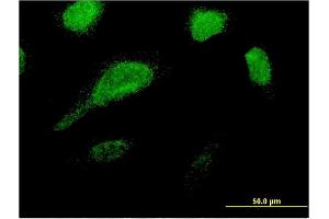 Immunofluorescence of monoclonal antibody to GLE1 on HeLa cell. (GLE1 Antikörper  (AA 140-240))