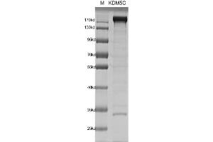Western Blotting (WB) image for Lysine (K)-Specific Demethylase 5C (KDM5C) protein (DYKDDDDK Tag) (ABIN2669682)