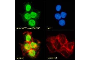 (ABIN185217) Immunofluorescence analysis of paraformaldehyde fixed A431 cells, permeabilized with 0. (BAF53A and BAF53B (C-Term) Antikörper)