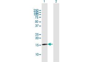 Western Blot analysis of TSEN15 expression in transfected 293T cell line by TSEN15 MaxPab polyclonal antibody. (TSEN15 Antikörper  (AA 1-171))