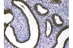 IHC analysis of MMP16 using anti-MMP16 antibody .