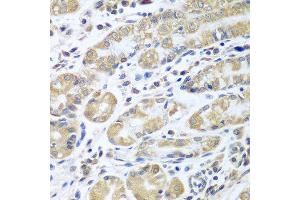 Immunohistochemistry of paraffin-embedded human stomach using EIF1AX antibody at dilution of 1:100 (40x lens). (EIF1AX Antikörper)