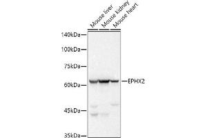 Western blot analysis of extracts of various cell lines, using EPHX2 antibody (ABIN7266999) at 1:500 dilution. (EPHX2 Antikörper)