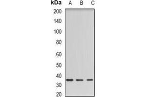 Western blot analysis of Barttin expression in HEK293T (A), rat liver (B), rat kidney (C) whole cell lysates. (BSND Antikörper)