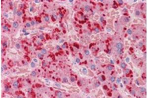 Human Liver: Formalin-Fixed, Paraffin-Embedded (FFPE) (APOA2 Antikörper  (AA 1-100))