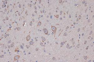 Immunohistochemistry of paraffin-embedded mouse brain using Xanthine Oxidase (XDH) (XDH) Rabbit mAb (ABIN7271408) at dilution of 1:100 (40x lens). (XDH Antikörper)
