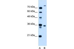 Western Blotting (WB) image for anti-FLJ22167 antibody (ABIN2464002) (FLJ22167 Antikörper)