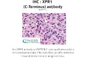 Image no. 1 for anti-Xenotropic and Polytropic Retrovirus Receptor 1 (xpr1) (C-Term) antibody (ABIN1740877) (xpr1 Antikörper  (C-Term))