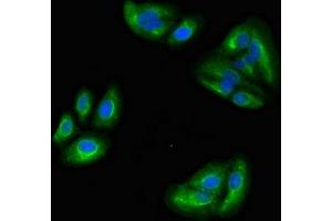 Immunofluorescence (IF) image for anti-Microtubule-Associated Protein, RP/EB Family, Member 2 (MAPRE2) (AA 159-240) antibody (ABIN7159766)