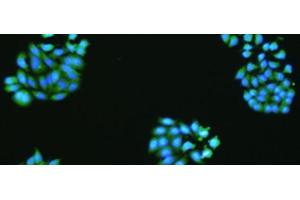 The image is immunofluorescence of HepG2 cell using VMA21 Polyclonal Antibody at dilution of 1:50.