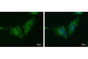 Immunofluorescence (IF) image for anti-Wingless-Type MMTV Integration Site Family, Member 11 (WNT11) (Center) antibody (ABIN2856232)
