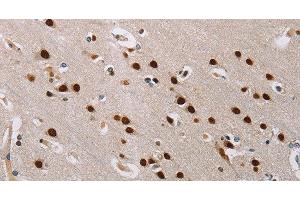 Immunohistochemistry of paraffin-embedded Human brain tissue using TONSL Polyclonal Antibody at dilution 1:60