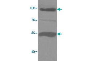 Western blot analysis of human fetal liver lysate with ADAMTS8 polyclonal antibody  at 1 : 1000 dilution. (ADAMTS8 Antikörper  (C-Term))