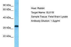 Host: Rabbit Target Name: SLX1B Sample Type: Fetal Brain lysates Antibody Dilution: 1. (SLX1A/GIYD2 Antikörper  (N-Term))