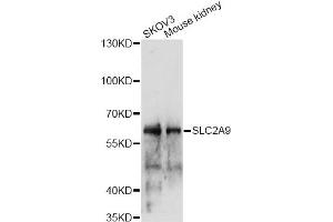 Western blot analysis of extracts of various cell lines, using SLC2A9 antibody (ABIN6291465) at 1:1000 dilution. (SLC2A9 Antikörper)