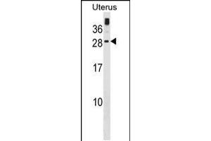 Western blot analysis in human Uterus tissue lysates (35ug/lane). (GUCA1C Antikörper  (C-Term))