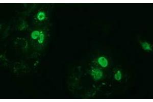 Anti-ZIM2 mouse monoclonal antibody (ABIN2453801) immunofluorescent staining of COS7 cells transiently transfected by pCMV6-ENTRY ZIM2 (RC211188). (ZIM2 Antikörper  (AA 1-150, AA 428-527))