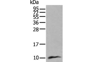Western blot analysis of Human lung tissue lysate using CCL18 Polyclonal Antibody at dilution of 1:400 (CCL18 Antikörper)
