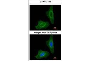 Image no. 2 for anti-Glutamate Decarboxylase 2 (Pancreatic Islets and Brain, 65kDa) (GAD2) (AA 353-556) antibody (ABIN467585)