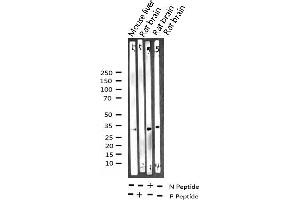 Western blot analysis of Phospho-NPM (Thr199) expression in various lysates (NPM1 Antikörper  (pThr199))