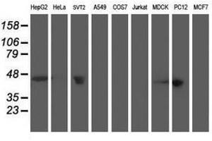Image no. 5 for anti-Aminoacylase 1 (ACY1) antibody (ABIN1496453) (Aminoacylase 1 Antikörper)