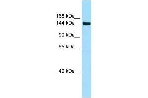 WB Suggested Anti-CD109 Antibody Titration: 1. (CD109 Antikörper  (Middle Region))