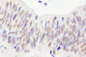 anti-NLR Family, Pyrin Domain Containing 2 (NLRP2) (AA 704-754) antibody