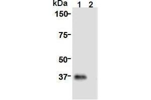 Western Blotting (WB) image for anti-Cell Division Cycle Associated 8 (CDCA8) (AA 1-280), (N-Term) antibody (ABIN1449290)