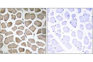 Immunohistochemistry analysis of paraffin-embedded human skeletal muscle tissue, using MOT12 Antibody. (MOT12 Antikörper  (AA 115-164))