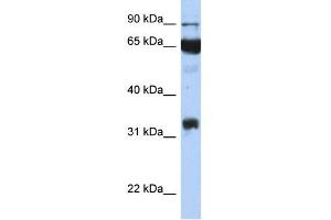 WB Suggested Anti-PTGS1 Antibody Titration:  0. (PTGS1 Antikörper  (Middle Region))
